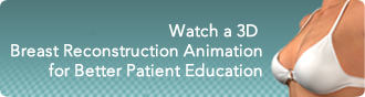 View 3d Animated Breast Reconstruction Video
