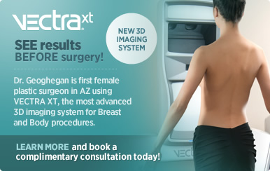 Vextra - See results before surgery!